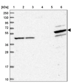 Lane 1: Marker [kDa] 250, 130, 95, 72, 55, 36, 28, 17, 10_br/_Lane 2: Human cell line RT-4_br/_Lane 3: Human cell line U-251MG sp_br/_Lane 4: Human plasma (IgG/HSA depleted)_br/_Lane 5: Human liver tissue_br/_Lane 6: Human tonsil tissue