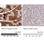 Anti-TNNC2 Antibody