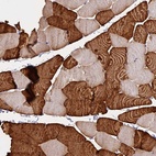 Immunohistochemical staining of human skeletal muscle shows high expression.