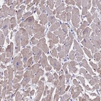 Immunohistochemical staining of human heart muscle shows low expression as expected.