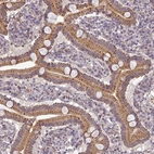 Anti-C14orf1 Antibody