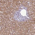 Immunohistochemical staining of human liver shows moderate cytoplasmic positivity in hepatocytes.