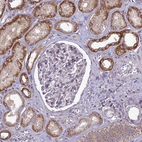 Immunohistochemical staining of human kidney shows moderate to strong cytoplasmic positivity in cells in tubules.