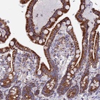 Anti-NDUFA5 Antibody