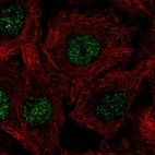 Anti-C17orf50 Antibody