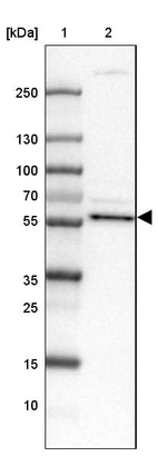 Lane 1: Marker [kDa] 250, 130, 100, 70, 55, 35, 25, 15, 10_br/_Lane 2: Human Tonsil tissue