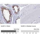Anti-ALMS1 Antibody