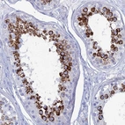 Immunohistochemical staining of human testis shows high expression.