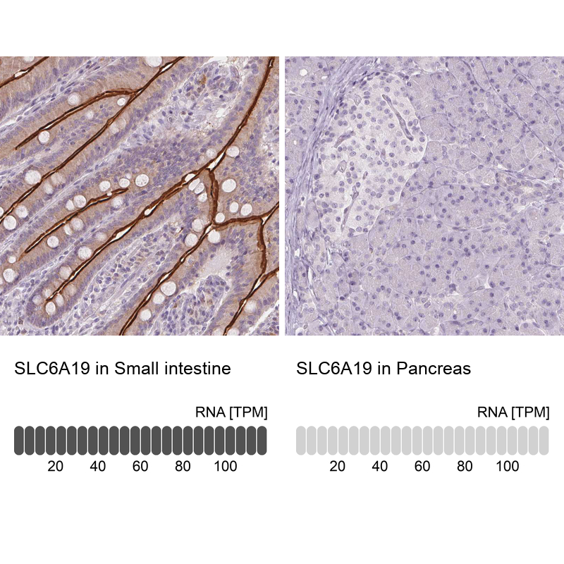 Anti-SLC6A19 Antibody