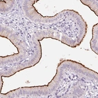 Immunohistochemical staining of human gallbladder shows strong positivity in apical membrane in glandular cells.