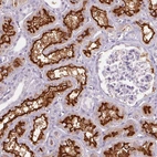 Immunohistochemical staining of human kidney shows strong membranous positivity in cells in tubules.