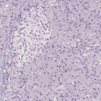 Immunohistochemical staining of human pancreas shows no membranous positivity in exocrine glandular cells as expected.