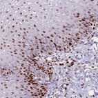 Anti-MFSD10 Antibody