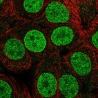 Immunofluorescent staining of human cell line MCF7 shows localization to nucleoplasm & nuclear membrane.