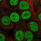 Immunofluorescent staining of human cell line MCF7 shows localization to nucleoplasm & nuclear membrane.