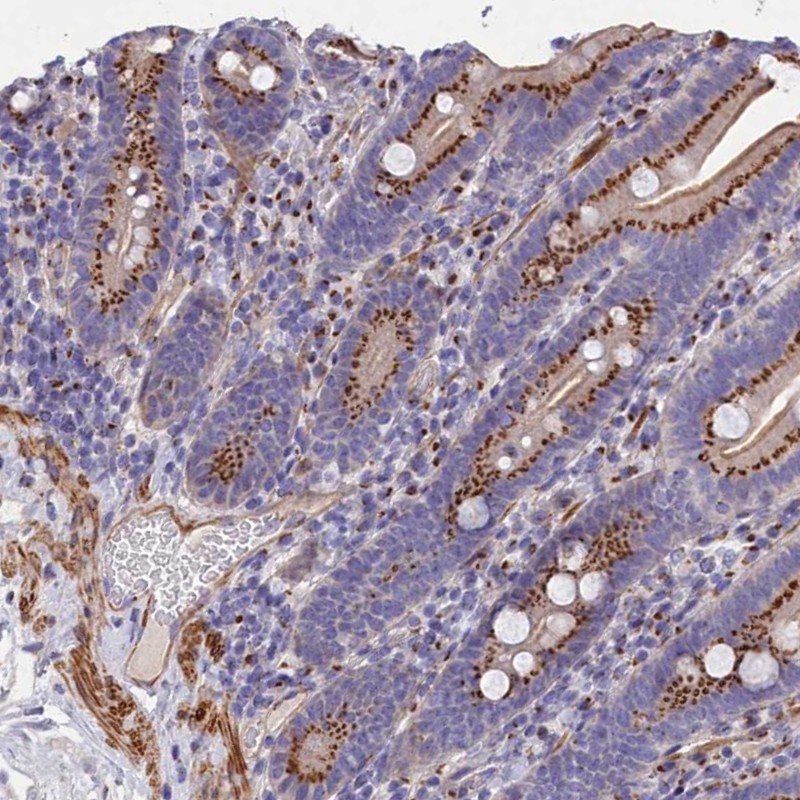 Anti-TUBGCP4 Antibody