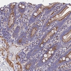 Anti-TUBGCP4 Antibody