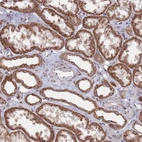 Anti-CCDC106 Antibody