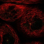Immunofluorescent staining of human cell line A-431 shows positivity in centrosome.
