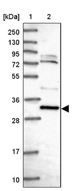 Lane 1: Marker [kDa] 250, 130, 95, 72, 55, 36, 28, 17, 10_br/_Lane 2: Human cell line RT-4