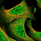 Immunofluorescent staining of human cell line U-2 OS shows localization to nucleoplasm & cytosol.