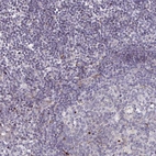 Immunohistochemical staining of human lymph node shows low expression as expected.