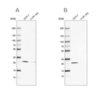 Anti-FAHD1 Antibody