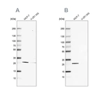 Western blot analysis using Anti-FAHD1 antibody HPA043226 (A) shows similar pattern to independent antibody HPA043534 (B).