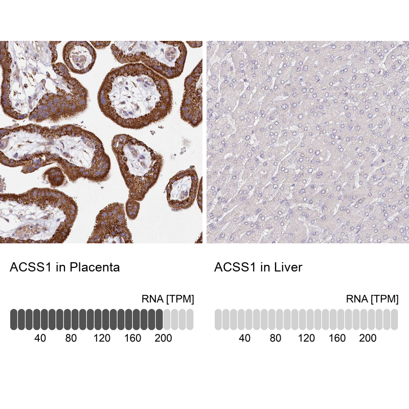 Anti-ACSS1 Antibody