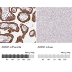 Anti-ACSS1 Antibody