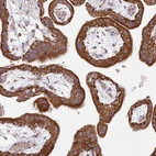Immunohistochemical staining of human placenta shows strong granular cytoplasmic positivity in trophoblastic cells.