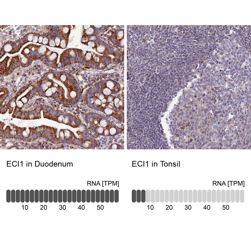 Anti-ECI1 Antibody