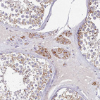 Anti-ACSS1 Antibody