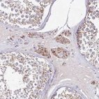 Immunohistochemical staining of human testis shows moderate granular cytoplasmic positivity in Leydig cells.