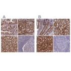 Immunohistochemical staining of human duodenum, kidney, liver and tonsil using Anti-ECI1 antibody HPA043227 (A) shows similar protein distribution across tissues to independent antibody HPA041746 (B).