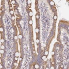 Immunohistochemical staining of human upper duodenum shows moderate granular cytoplasmic positivity in glandular cells.