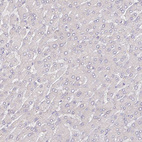 Immunohistochemical staining of human liver shows no positivity in hepatocytes as expected.