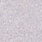 Immunohistochemical staining of human liver shows no positivity in hepatocytes as expected.
