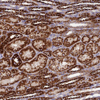 Immunohistochemical staining of human kidney shows strong granular cytoplasmic positivity in cells in tubules.