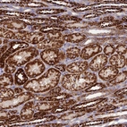 Immunohistochemical staining of human kidney shows strong granular cytoplasmic positivity in cells in tubules.