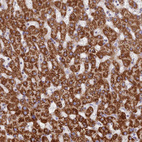 Immunohistochemical staining of human liver shows strong granular cytoplasmic positivity in hepatocytes.