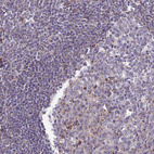 Immunohistochemical staining of human tonsil shows very weak granular cytoplasmic positivity in germinal center cells.