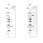 Western blot analysis using Anti-ECI1 antibody HPA043227 (A) shows similar pattern to independent antibody HPA041746 (B).
