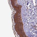 Anti-VPS16 Antibody