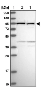Lane 1: Marker [kDa] 250, 130, 95, 72, 55, 36, 28, 17, 10_br/_Lane 2: Human cell line RT-4_br/_Lane 3: Human cell line U-251MG sp