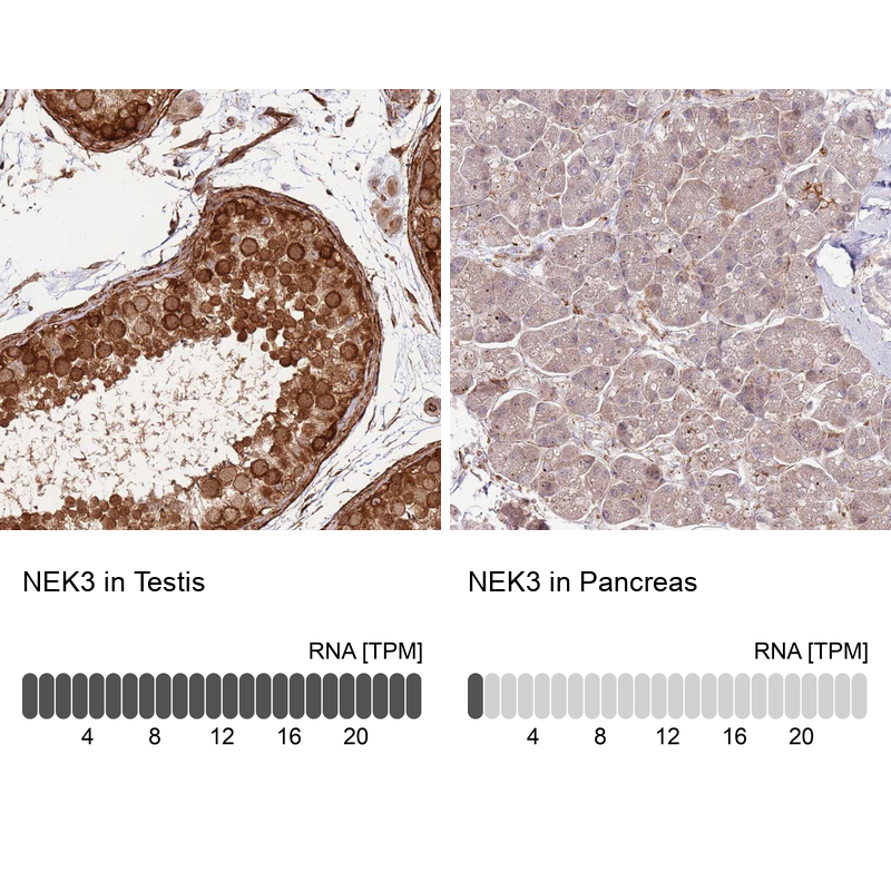 Anti-NEK3 Antibody