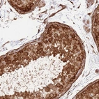 Immunohistochemical staining of human testis shows high expression.