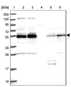 Lane 1: Marker [kDa] 250, 130, 95, 72, 55, 36, 28, 17, 10_br/_Lane 2: Human cell line RT-4_br/_Lane 3: Human cell line U-251MG sp_br/_Lane 4: Human plasma (IgG/HSA depleted)_br/_Lane 5: Human liver tissue_br/_Lane 6: Human tonsil tissue