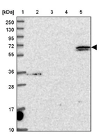Lane 1: Marker [kDa] 250, 130, 95, 72, 55, 36, 28, 17, 10_br/_Lane 2: Human cell line RT-4_br/_Lane 3: Human cell line U-251MG sp_br/_Lane 4: Human plasma (IgG/HSA depleted)_br/_Lane 5: Human liver tissue