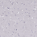 Immunohistochemical staining of human cerebral cortex shows no positivity in neurons as expected.